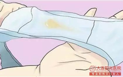 妇科检查