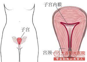 【不孕】子宫内膜增厚的原因是什么